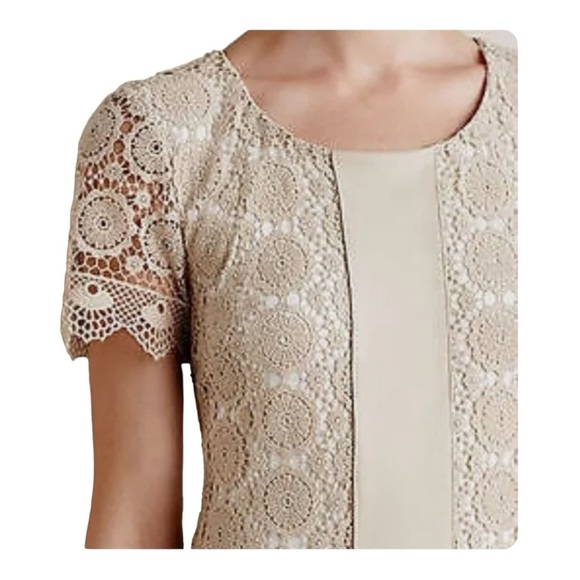 ANTHROPOLOGIE Bailey 44 NWT Vegan Leather & Lace Shift Dress Neutral Size XS - Picture 3 of 3